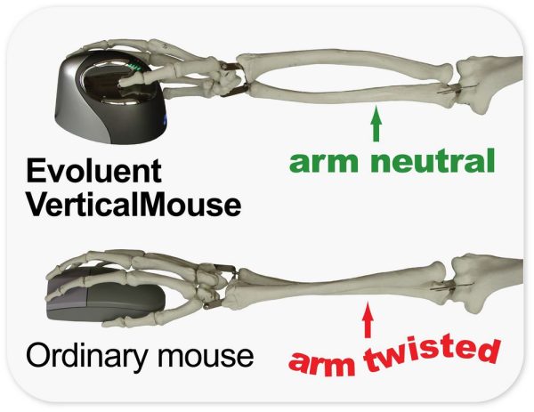 Evoluent Vertical Mouse 4 - Image 2